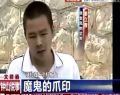 视频徐州男子为骗保险在妻子头上打钢钉.rar